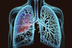 Flowchart for management of new nodules. New nodules that had been missed or not reported on previous scans are managed according to the same rules as nodules found at baseline.