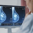 Mammogram Dense Breasts Cropped
