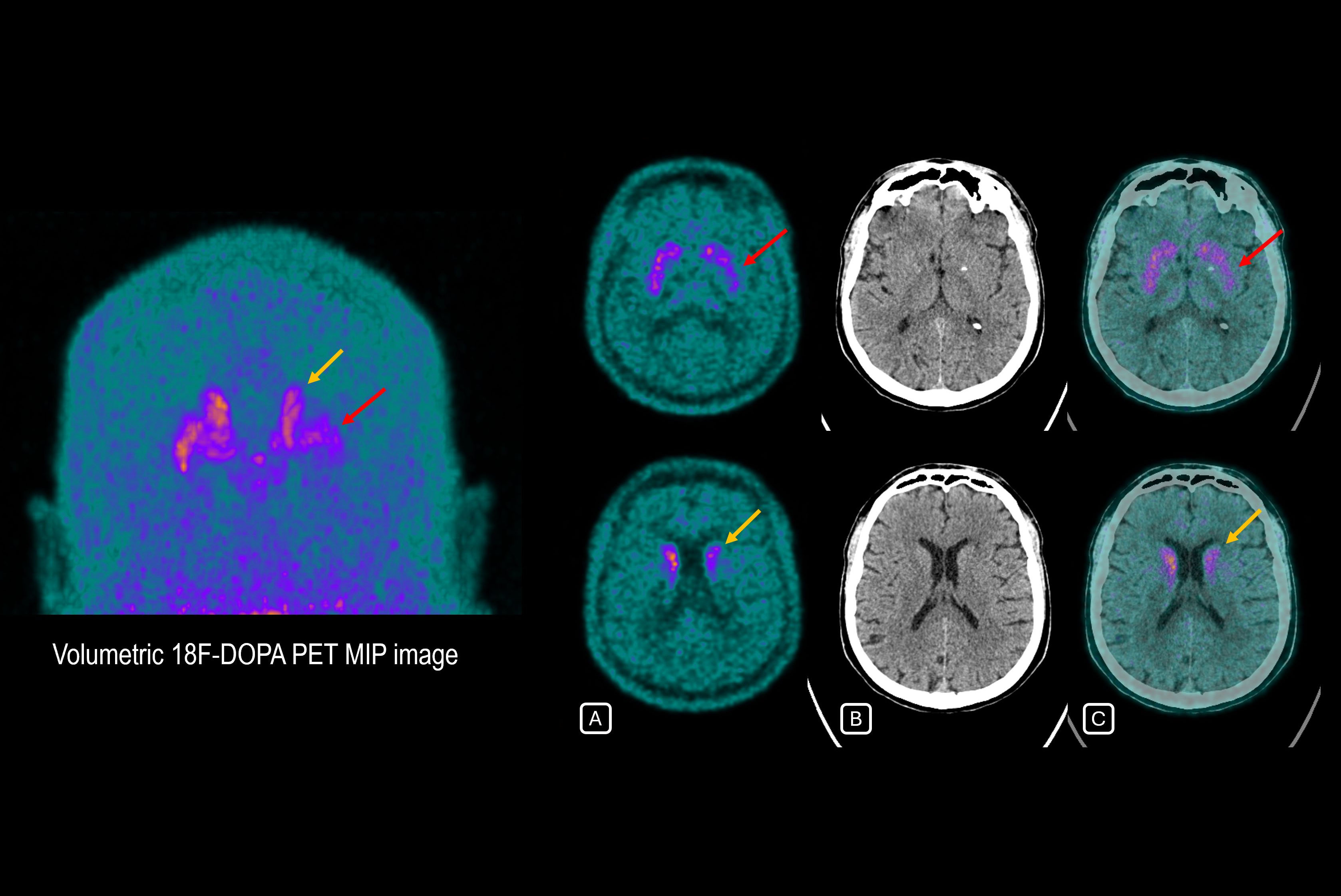 2025 08 14 Mol Insider Figure 7 Thumbnail
