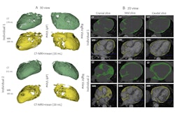 2025 08 14 Rad Cardiothor Firouznia Fig1 Thumbnail