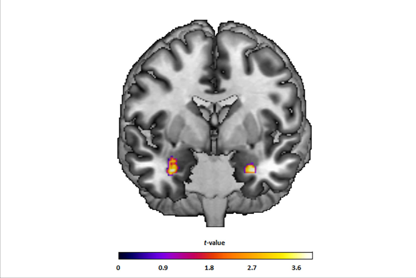 2025 08 27 Translational Psych Zwiky Fig1 Thumbnail