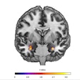 2025 08 27 Translational Psych Zwiky Fig1 Thumbnail