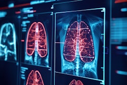 Ai Lung Image Monitor Adobe Flat Flow