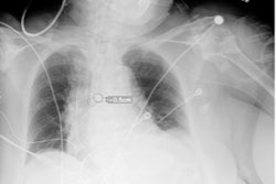 Ett Ai svz Zq H Up Po