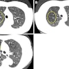 2025 09 09 Radiology Gutierrez Fig1