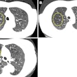2025 09 09 Radiology Gutierrez Fig1