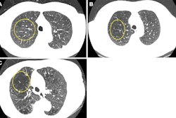 2025 09 09 Radiology Gutierrez Fig1