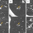 2025 09 16 Radiology Antonissen Fig4 Thumbnail