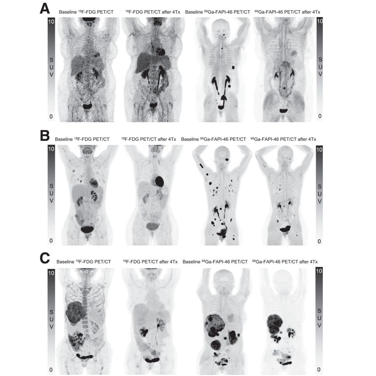 2025 09 17 Y90 Fapi 46 400