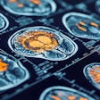 Brain Scans Adobe Deep View