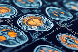 Brain Scans Adobe Deep View