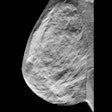 Breast Tomosynthesis Digital Social