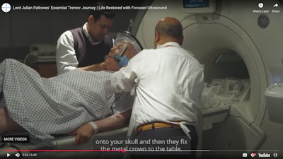 MR-guided focused ultrasound was performed on Julian Fellowes at St. Mary's Hospital.