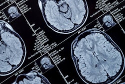 Mri Brain Head 400