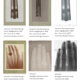 Six historic x-ray images from the estate of Wilhelm Conrad Röntgen.