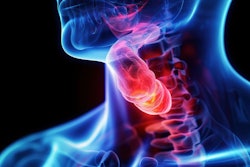 Throat Cancer 3 D