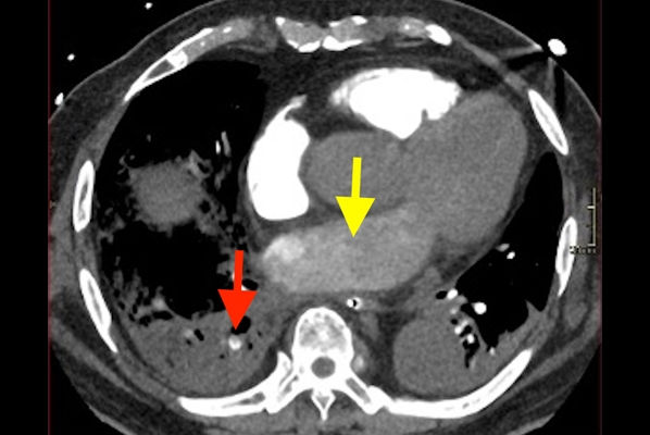2025 10 06 Jfr Imaging Of Elderly Fig 1 Thumbnail