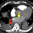 2025 10 06 Jfr Imaging Of Elderly Fig 1 Thumbnail