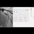 2025 10 11 Er Peters Fig3 Thumbnail