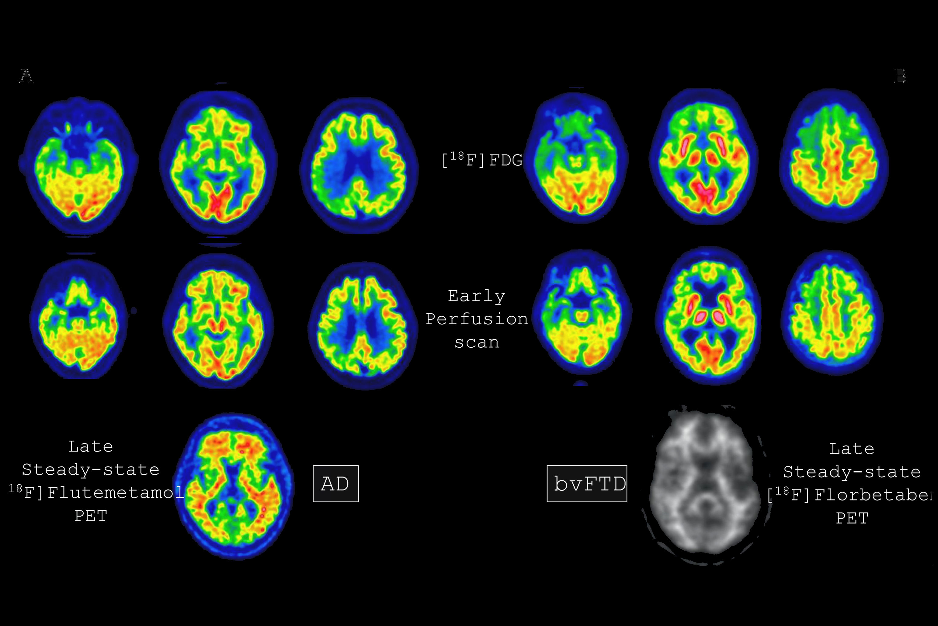 2025 10 20 Eanm Early Perfusion Imaging Fig1 Thumbnail