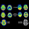 2025 10 20 Eanm Early Perfusion Imaging Fig1 Thumbnail