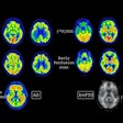 2025 10 20 Eanm Early Perfusion Imaging Fig1 Thumbnail