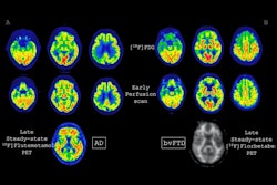 2025 10 20 Eanm Early Perfusion Imaging Fig1 Thumbnail