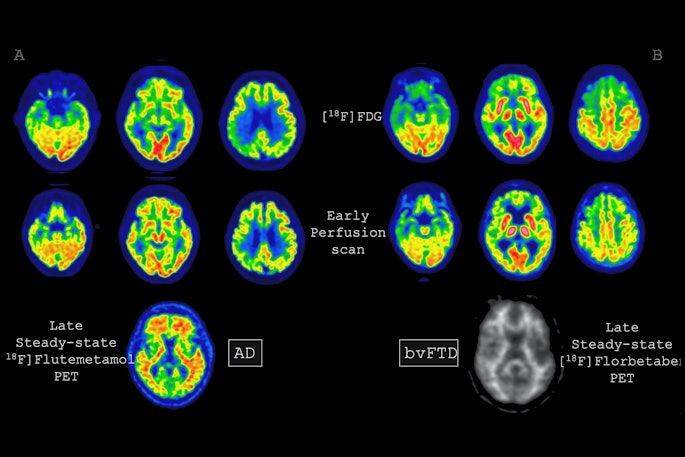 2025 10 20 Eanm Early Perfusion Imaging Fig1 Thumbnail