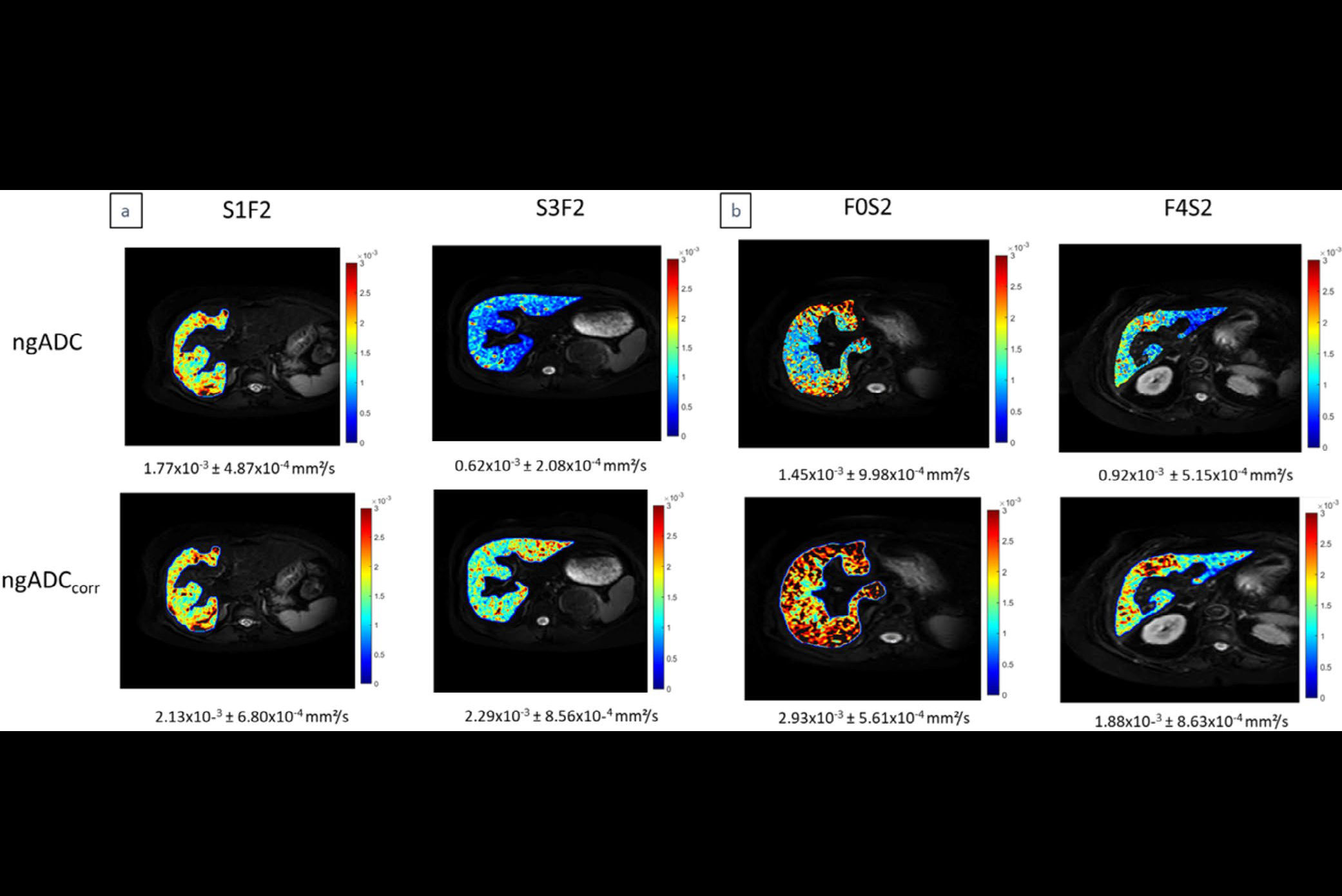 2025 10 24 Jmri Said Fig2 Thumbnail