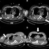 2025 10 28 Gunshot Wounds Fig1 Thumbnail