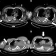 2025 10 28 Gunshot Wounds Fig1 Thumbnail