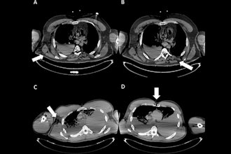 2025 10 28 Gunshot Wounds Fig1 Thumbnail