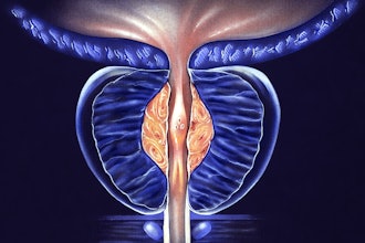 Benign Prostatic Hyperplasia
