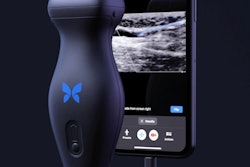 Butterfly Network I Q