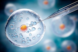 Egg Needle In Vitro Fertilization Adobe Alona