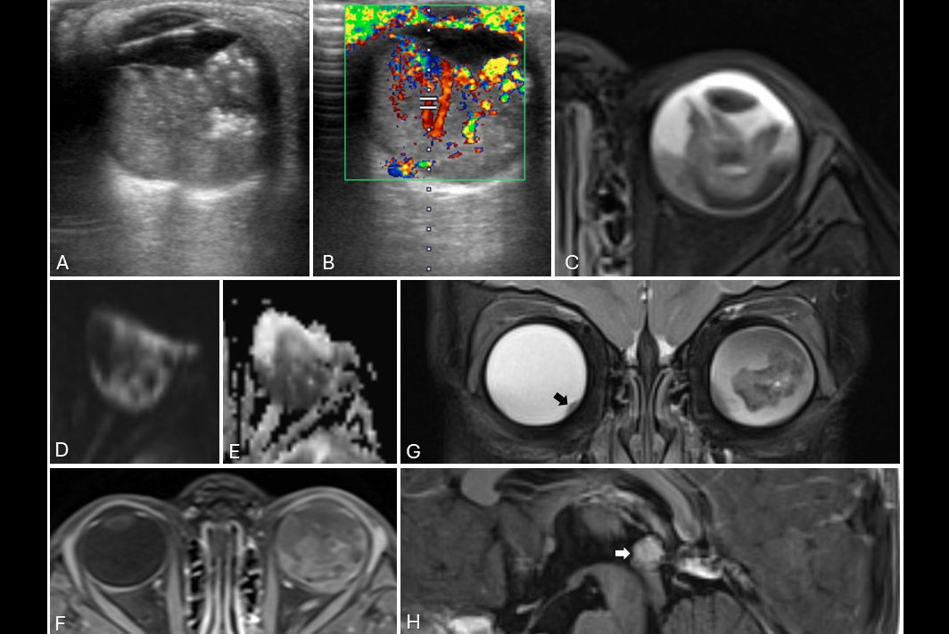 Mri Insider 2025 10 30 Fig 6 Thumbnail