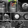 Mri Insider 2025 10 30 Fig 6 Thumbnail