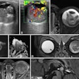 Mri Insider 2025 10 30 Fig 6 Thumbnail