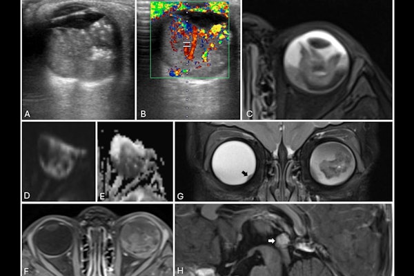 Mri Insider 2025 10 30 Fig 6 Thumbnail