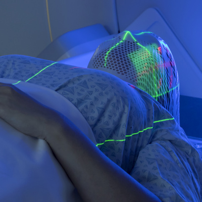 Radiation Therapy Planning 400