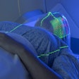 Radiation Therapy Planning 400