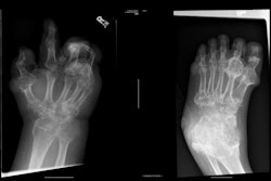 2025 11 13 X Ray Insider Figure5 6