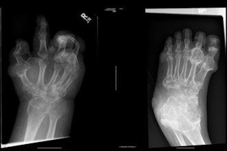 2025 11 13 X Ray Insider Figure5 6