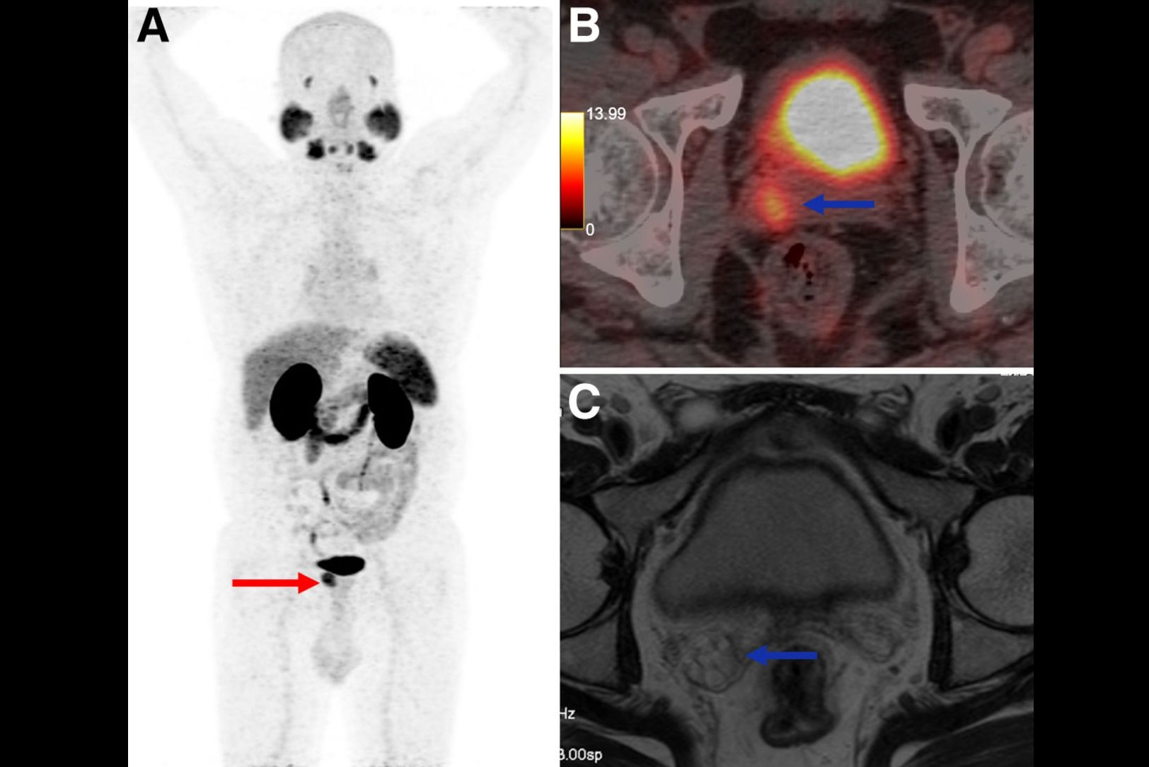 2025 11 14 Iaea Recommends Psma Pet Thumbnail