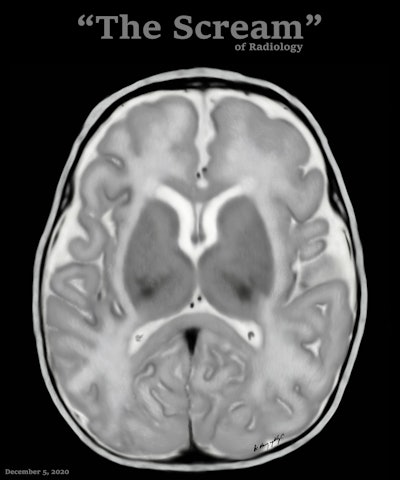 2025 11 20 20 Scream