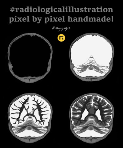 2025 11 20 Pixel By Pixel