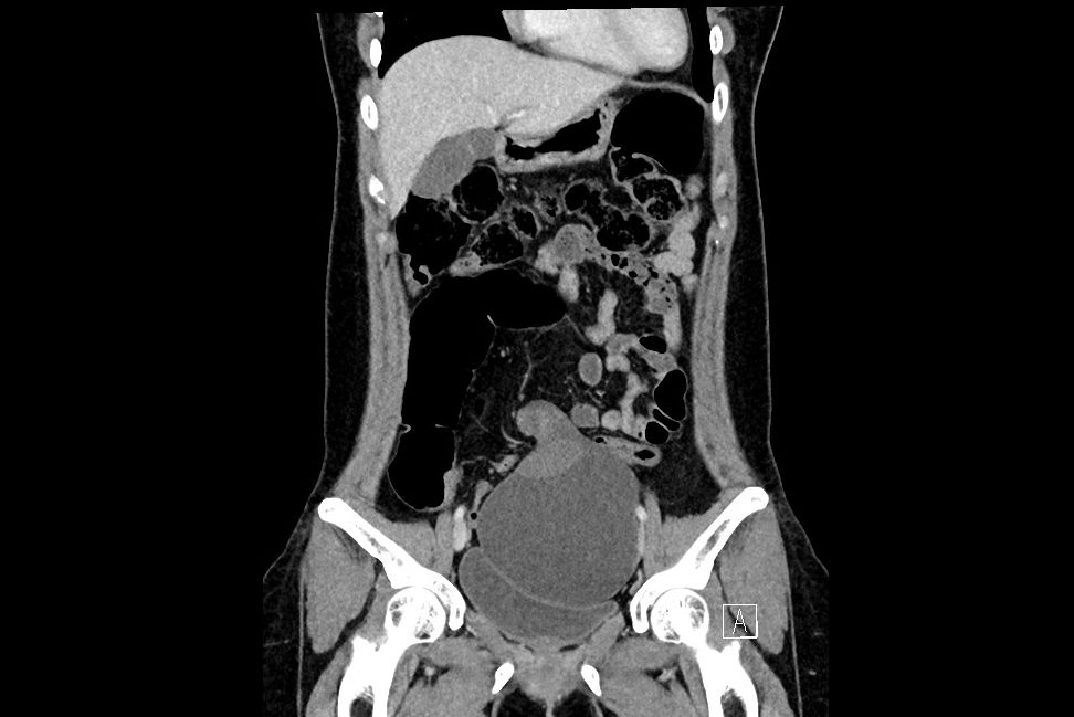 2025 11 3 Ranzcr Ct Fig1 Thumbnail
