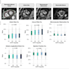 Cardiac MRI analysis can provide useful information on epicardial adipose tissue, infarct size, microvascular obstruction, and myocardial edema.