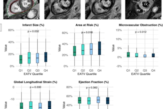 Cardiac MRI analysis can provide useful information on epicardial adipose tissue, infarct size, microvascular obstruction, and myocardial edema.