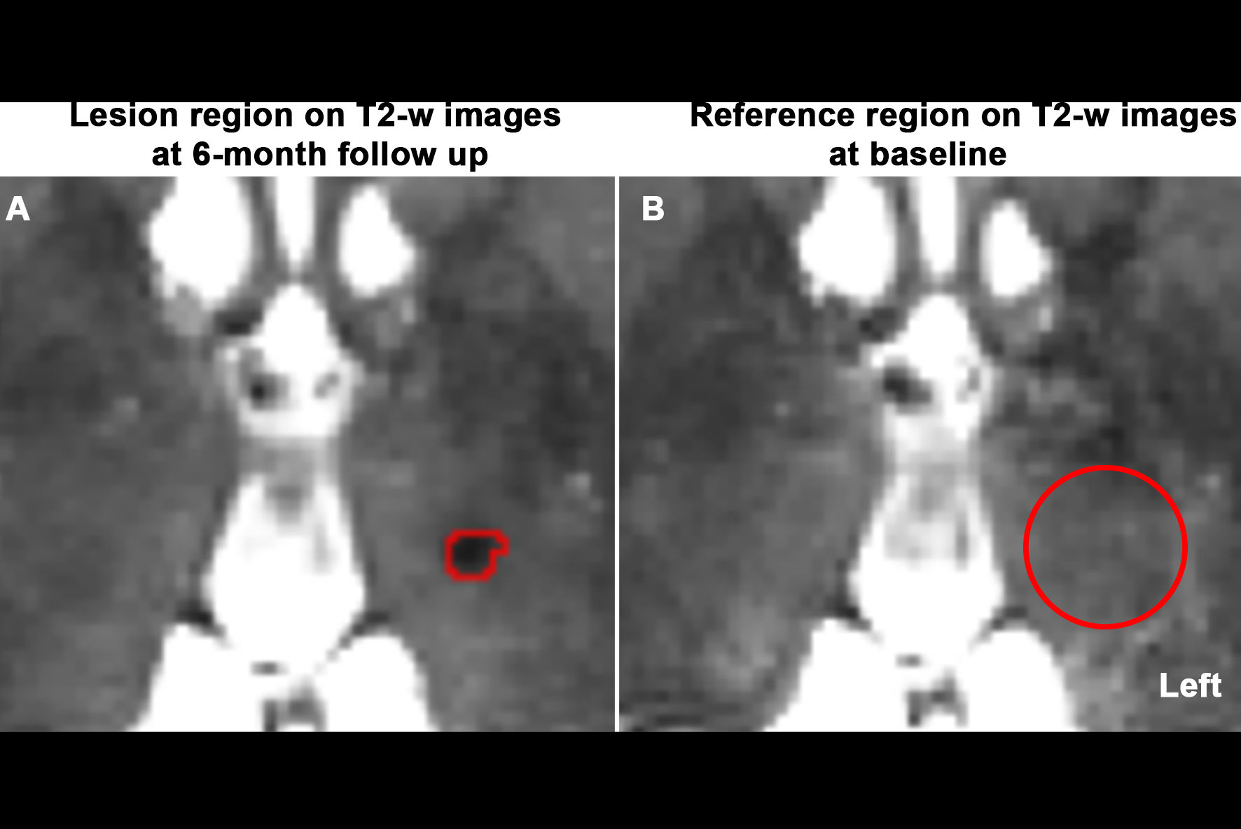 2025 12 16 Radiology Mrgfus Brain Thumbnail